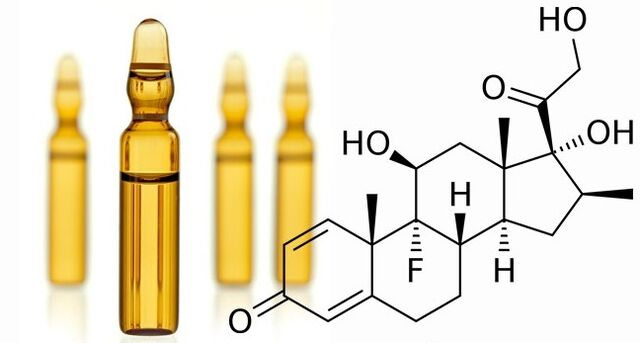 Artroosi süstimine