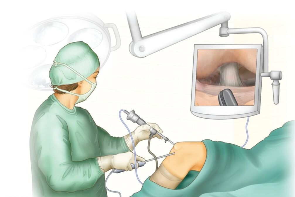Põlveliigese operatsioon