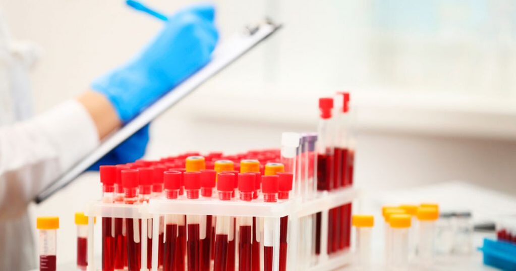 Vereanalüüsi teostamine põletiku tuvastamiseks