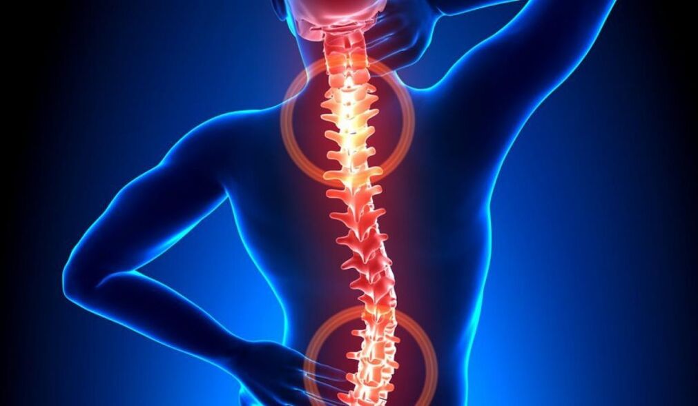 seljaaju osteokondroos